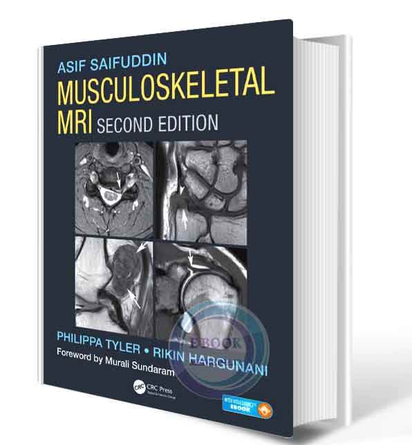 دانلود کتابMusculoskeletal MRI 2nd(PDF)